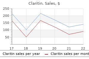 claritin 10 mg cheap fast delivery