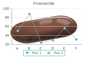 buy 1 mg finasteride visa