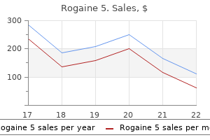 rogaine 5 60 ml order without prescription