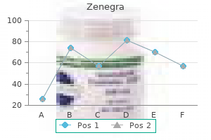 purchase 100 mg zenegra with visa