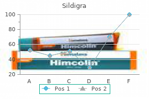 sildigra 100 mg discount mastercard