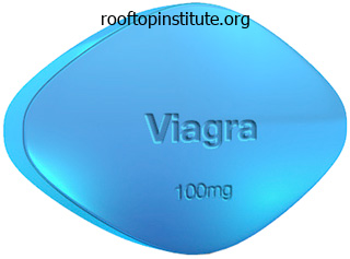 25 mg viagra cheap with amex